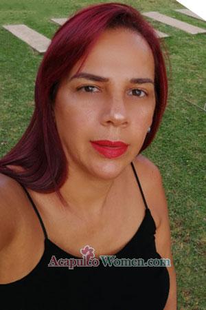201876 - Teresa Age: 59 - Costa Rica